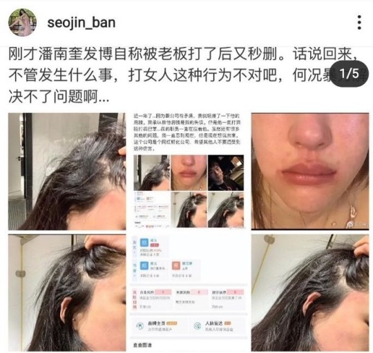 0000257614_002_20200427074426688.jpg?typ