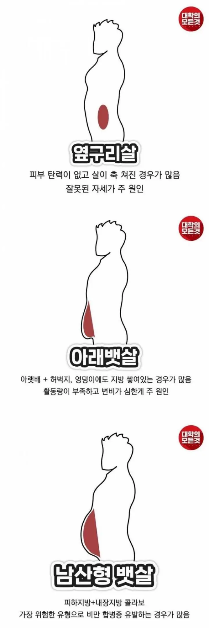 뱃살 유형별 '살 찐 이유'