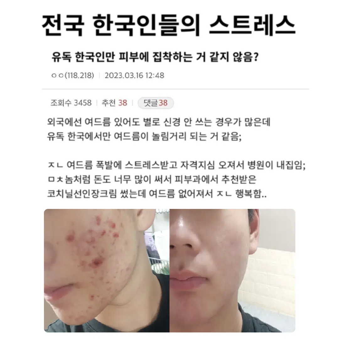 유독 한국에서만 지단발광인것들