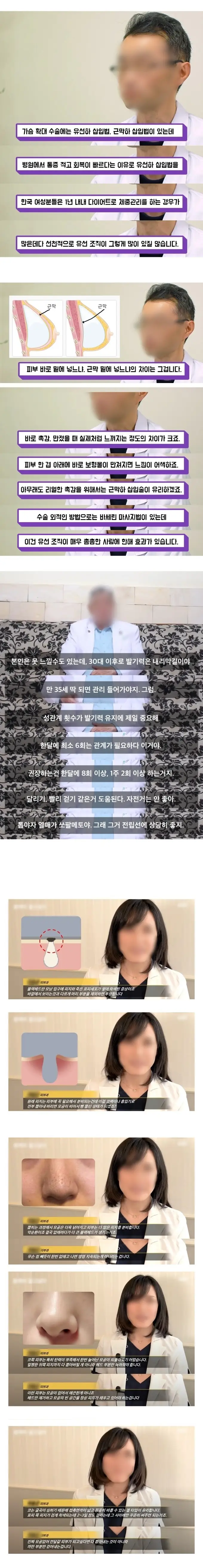 촉감이 ㄹㅇ 진짜같다는 가슴수술법