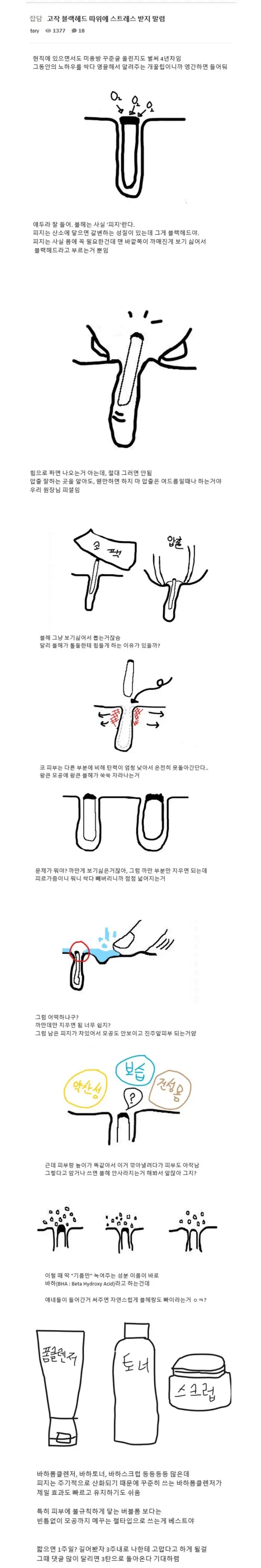 블랙헤드가 생기는 진짜 이유 (펌)