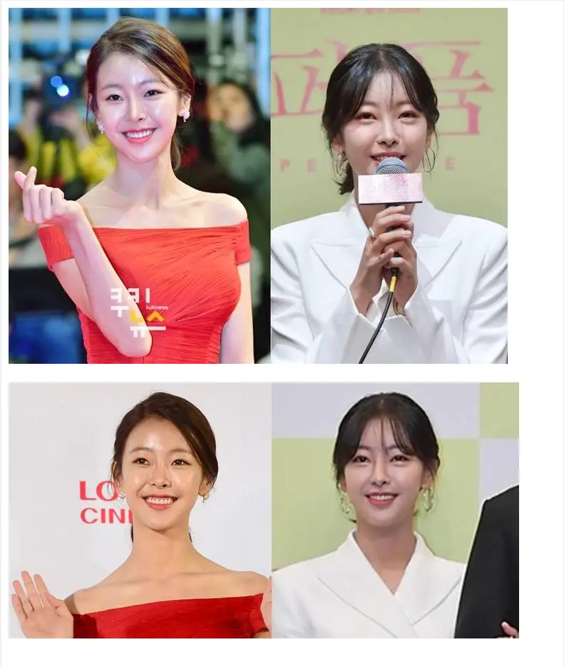 성형 인정한 고원희