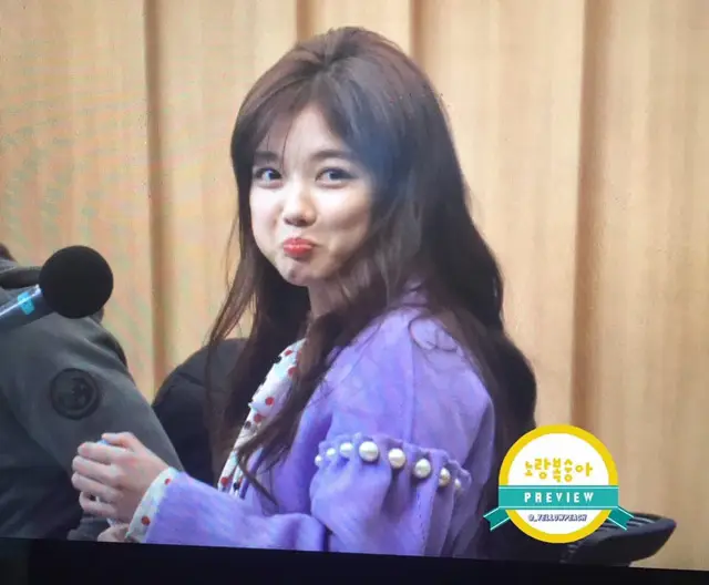 사랑니 뽑고 라디오 녹화 간 김유정