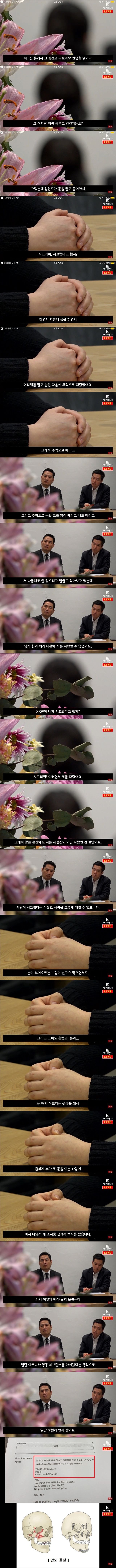 김건모 폭행 피해자 인터뷰