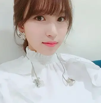 트와이스 미나. 건강상 문제로 월드투어 불참