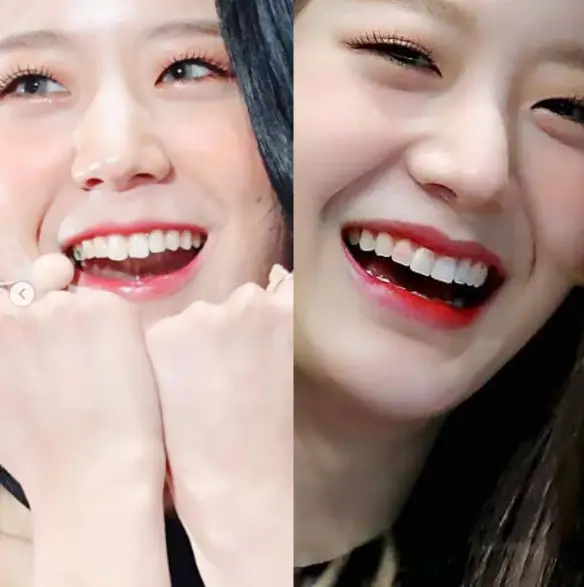 프로미스나인 장규리 치아교정 전후