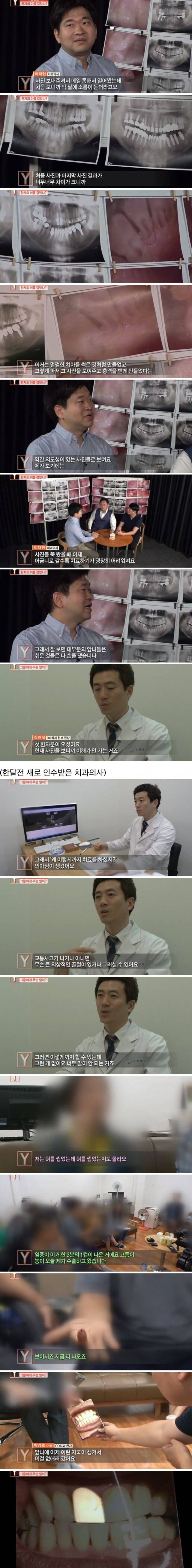 치과의사들도 충격받았다는 진료사진.jpg