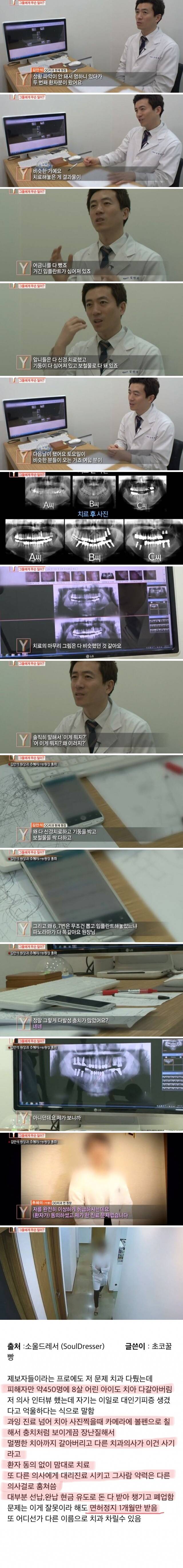 치과의사들도 충격받았다는 진료사진.jpg