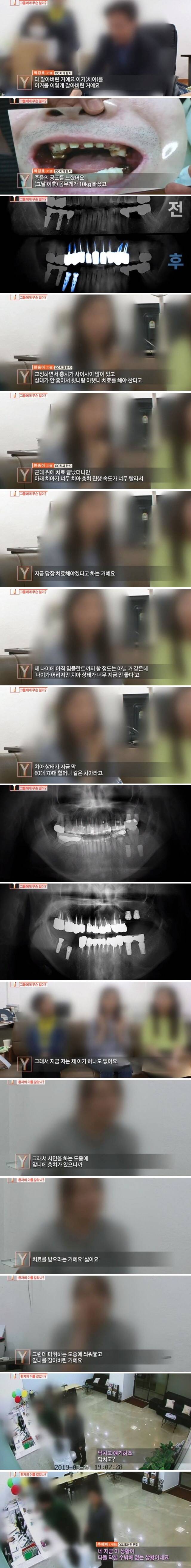 치과의사들도 충격받았다는 진료사진.jpg