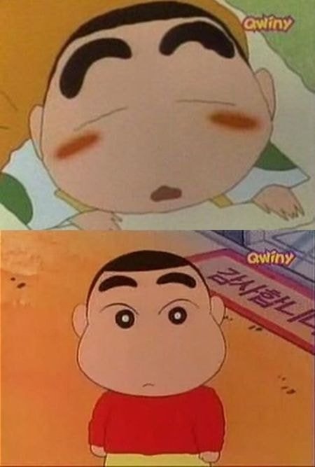희귀하다는 짱구 정면 얼굴