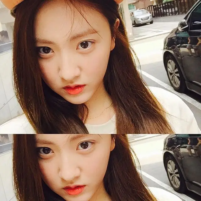 해령(베스티) 160407 인스타그램 - 퉁퉁..부었다